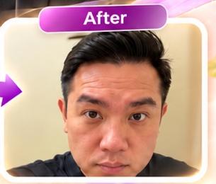 After